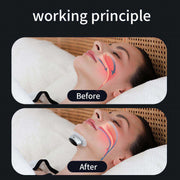 Illustration of the Smart Snoring Stopper Device by eprolo demonstrating its working principle. Before and after comparison showing improved airflow and reduced snoring.